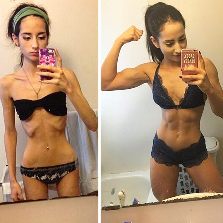 A transformation picture of Sarah Ramadan - on the left, an image of her while suffering from anorexia, and the right depicting a powerful figure after recovering and lifting weights.