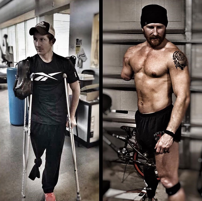 Jared Bullock on crutches compared to how he looks now.