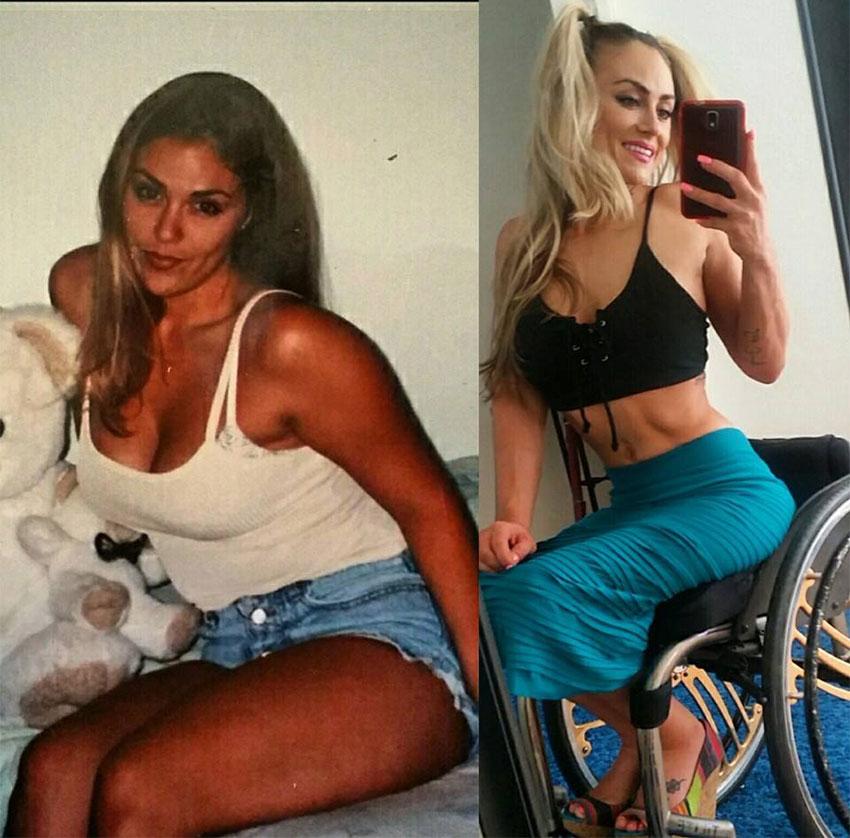 Tiphany Adams before her accident compared to how she looks now.