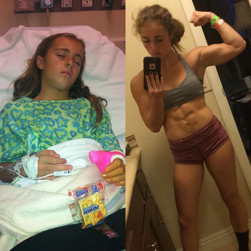 Demi Bagby just after her injury compared to how she looks now.