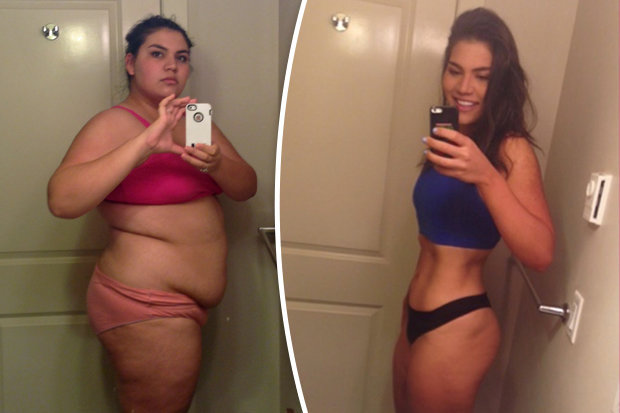 Laura Micetich's incredible weight-loss transformation before-after