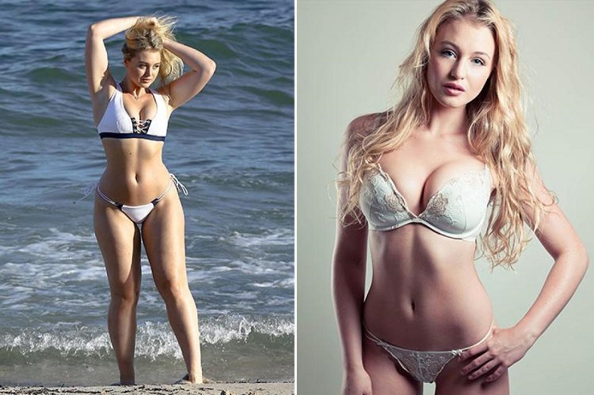 Iskra Lawrence before-after