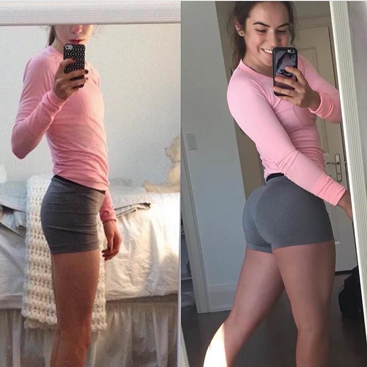 Kenzie Forbes transformation from anorexic to healthy and fit