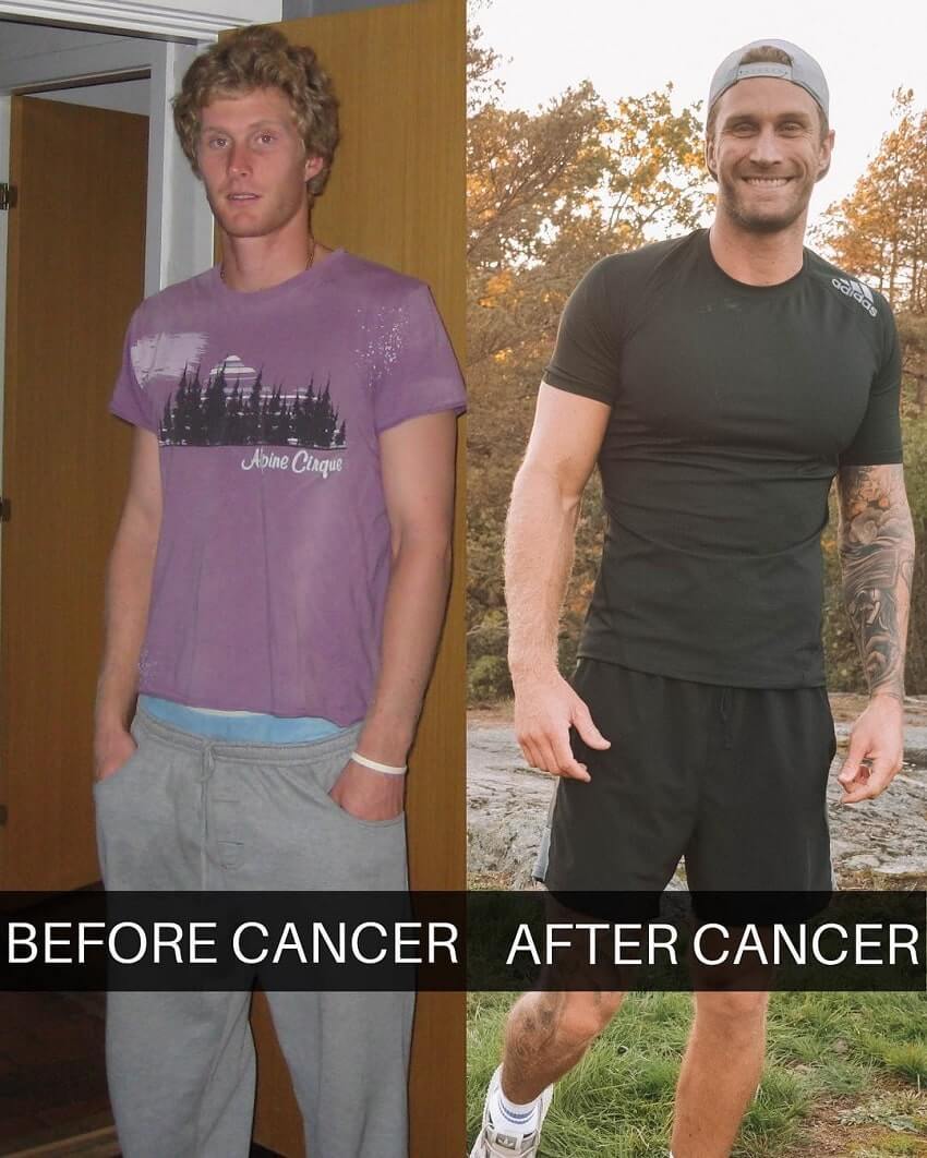 Matt Fox amazing body transformation before and after cancer