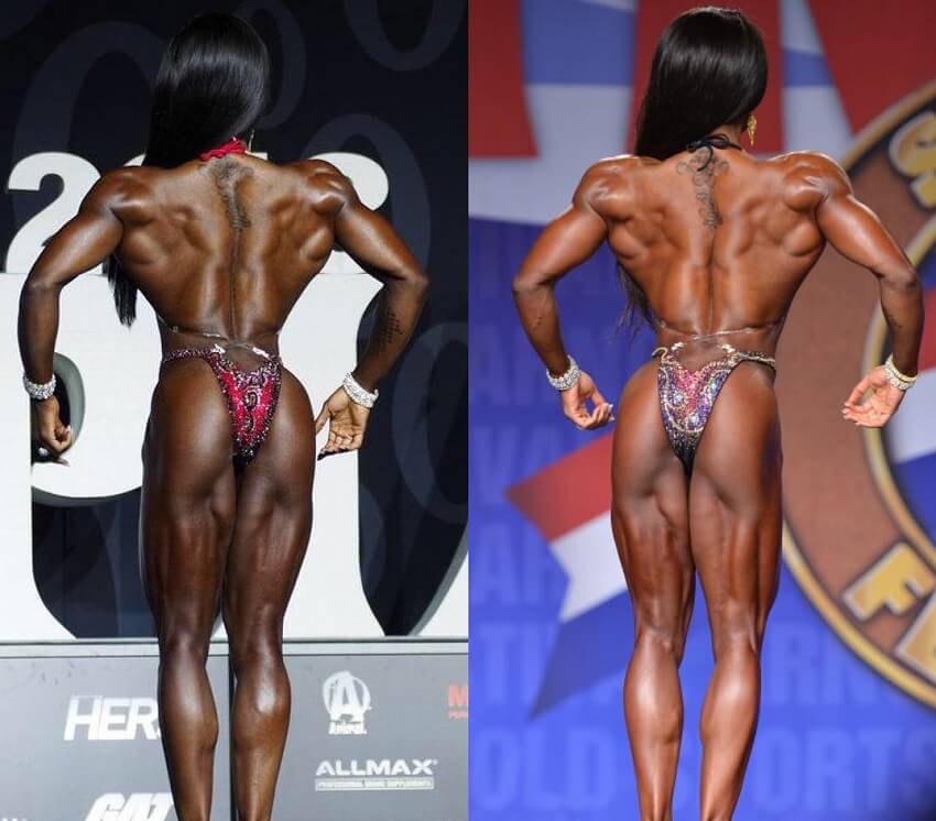 Cydney Gillon's back transformation before and after